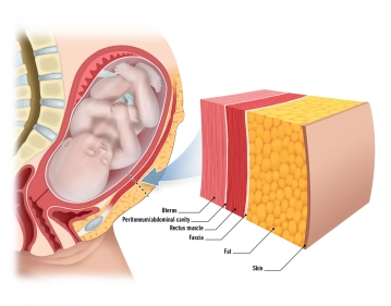 Pele e tecido subcutâneo