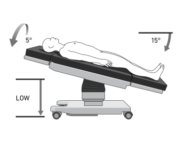 513_Lagerung Fusstief.jpeg
