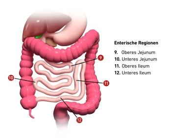 Índice de Sugarbaker (Índice de Câncer Peritoneal) 2