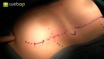 Definição de marcos topográficos