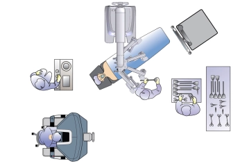 Posicionamiento y configuración 2