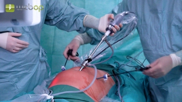 Colocação de trocater; Avaliação dos achados