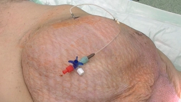 Preparação Especial