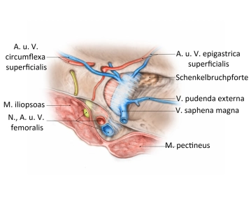 Anatomía topográfica de la puerta de la hernia femoral desde el exterior
