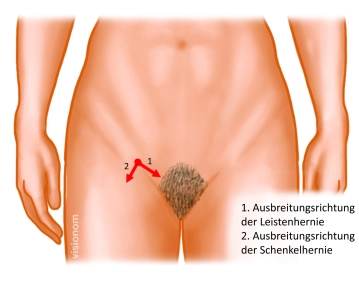 Diagnóstico preoperatorio