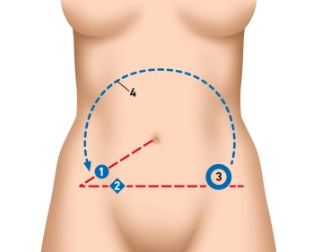 Diagnósticos Pré-operatórios