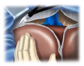 Mobilização do Fígado