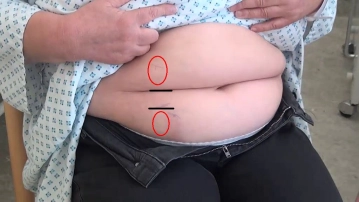 Preparação especial