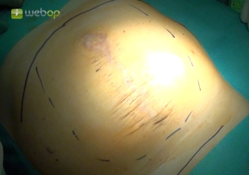 Marcando os 'pontos de referência'