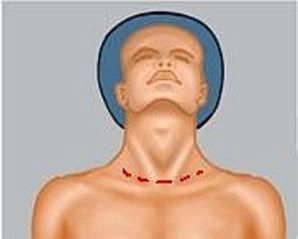 Prevenção e manejo de complicações intraoperatórias