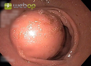 Avaliação Pré-Operatória