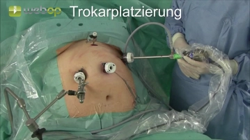 Posicionando os trocateres