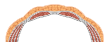 Estrutura da Parede Abdominal Anterior