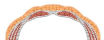 Fáscias e Peritônio