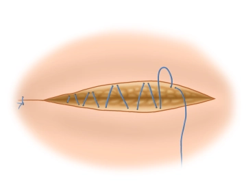 Encerrando a operação