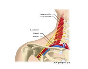 Anatomia e patogênese da TOS