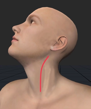 Acesso cervical esquerdo