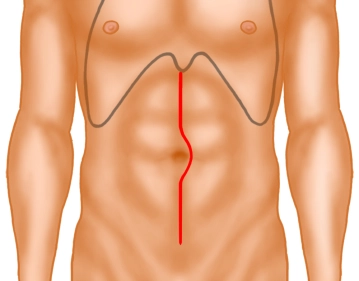 Laparotomia e Exposição
