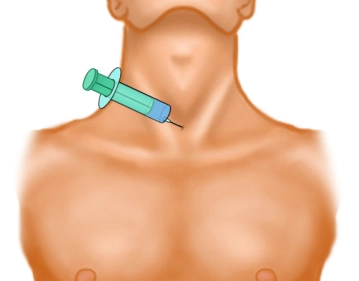 Anestesia do Local Cirúrgico