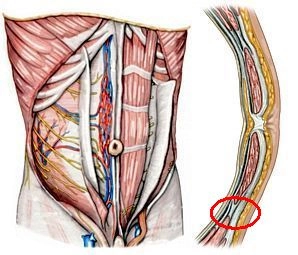 Anatomia cirúrgica da parede abdominal anterior