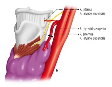 Preparação dos Vasos do Polo Superior