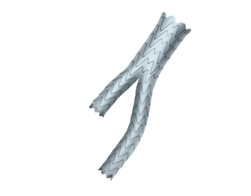 Preparação do Corpo Principal da Prótese