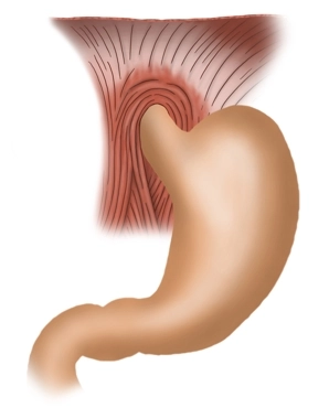Anatomia Cirúrgica do Esôfago/Estômago