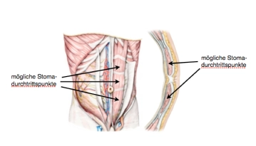 Anatomia da parede abdominal anterior