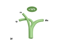 40_LAV_03_f_Gallenwege