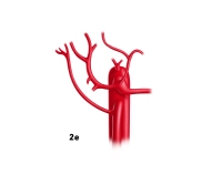 44_LAV_02_e_Leberarterie